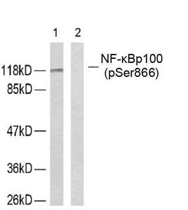 Western blot analysis of extracts from ovary cancer cells using NF-κB p100 (phospho-Ser866) antibody.Rabbit anti-Human NFKB2 Polyclonal Antibody
