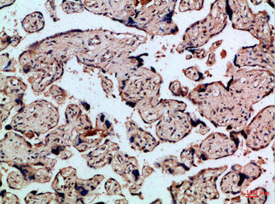 Immunohistochemical analysis of paraffin-embedded Human-placenta, antibody was diluted at 1:100Rabbit anti-Human FLT4 Polyclonal Antibody