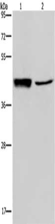 Gel: 8%SDS-PAGE, Lysate: 40 μg, Lane 1-2: Human hepatocellular carcinoma tissue, A549 cells, Primary antibody: GRPR Antibody(GRPR Antibody) at dilution 1/300, Secondary antibody: Goat anti rabbit IgG at 1/8000 dilution, Exposure time: 5 minutesRabbit anti-Human GRPR Polyclonal Antibody