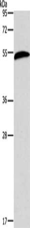 Gel: 12%SDS-PAGE, Lysate: 60 μg, Lane: Mouse liver tissue, Primary antibody: AEBP2 Antibody(AEBP2 Antibody) at dilution 1/225, Secondary antibody: Goat anti rabbit IgG at 1/8000 dilution, Exposure time: 20 secondsRabbit anti-Human AEBP2 Polyclonal Antibody