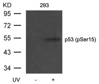 Western blot analysis of extracts from 293 cells untreated or treated with UV using p53(Phospho-Ser15) Antibody.Rabbit anti-Human TP53 Polyclonal Antibody