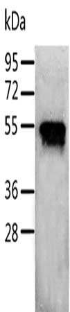 Gel: 10%SDS-PAGE, Lysate: 40 μg, Lane: Jurkat cells, Primary antibody: RUNX3 Antibody(RUNX3 Antibody) at dilution 1/400, Secondary antibody: Goat anti rabbit IgG at 1/8000 dilution, Exposure time: 1 minuteRabbit anti-Human RUNX3 Polyclonal Antibody