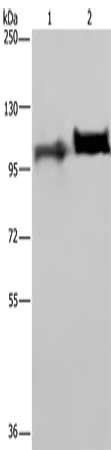 Gel: 6%SDS-PAGE, Lysate: 40 μg, Lane 1-2: Human placenta tissue, Human serum, Primary antibody: PLG Antibody(PLG Antibody) at dilution 1/200, Secondary antibody: Goat anti rabbit IgG at 1/8000 dilution, Exposure time: 2 minutes