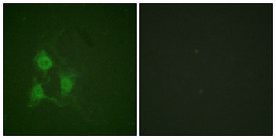 Immunofluorescence staining of methanol-fixed A549 cells using PKA α/β CAT (Phospho-Thr197) Antibody.Rabbit anti-Human PRKACA Polyclonal Antibody