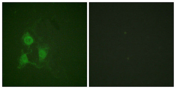 Immunofluorescence staining of methanol-fixed A549 cells using PKA α/β CAT (Phospho-Thr197) Antibody.Rabbit anti-Human PRKACA Polyclonal Antibody