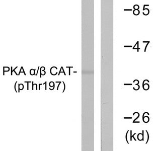 Western blot analysis of extracts from mouse brain cells using PKA α/β CAT (Phospho-Thr197) Antibody.The lane on the right is treated with the antigen-specific peptide.Rabbit anti-Human PRKACA Polyclonal Antibody