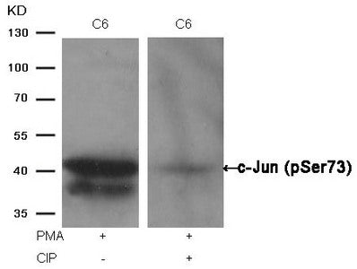 Western blot analysis of extracts from C6 cells, treated with PMA or calf intestinal phosphatase (CIP), using c-Jun (Phospho-Ser73) Antibody.