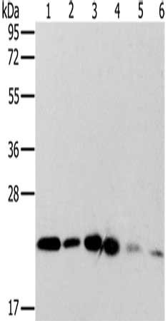 Gel: 10%SDS-PAGE, Lysate: 40 μg, Lane 1-6: Hela cells, hepg2 cells, lncap cells, K562 cells, Jurkat cells, A549 cells, Primary antibody: MRPL11 Antibody(MRPL11 Antibody) at dilution 1/300, Secondary antibody: Goat anti rabbit IgG at 1/8000 dilution, Exposure time: 15 secondsRabbit anti-Human MRPL11 Polyclonal Antibody