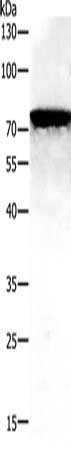 Gel: 10%SDS-PAGE, Lysate: 40 μg, Lane: Human fetal kidney tissue, Primary antibody: PAK7 Antibody(PAK7 Antibody) at dilution 1/100, Secondary antibody: Goat anti rabbit IgG at 1/8000 dilution, Exposure time: 3 minutesRabbit anti-Human PAK7 Polyclonal Antibody