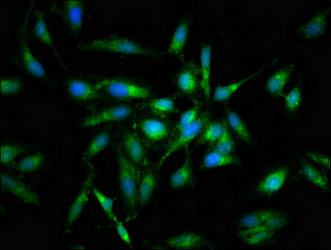 Immunofluorescent analysis of Hela cells using PRKCB Antibody at dilution of 1:100 and Alexa Fluor 488-congugated AffiniPure Goat Anti-Rabbit IgG(H+L)Rabbit anti-Human PRKCB Polyclonal Antibody