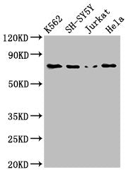 Western Blot | Positive WB detected in: K562 whole cell lysate, SH-SY5Y whole cell lysate, Jurkat whole cell lysate, Hela whole cell lysate | All lanes: PRKCB antibody at 3μg/ml | Secondary | Goat polyclonal to rabbit IgG at 1/50000 dilution | Predicted band size: 77, 78 kDa | Observed band size: 77 kDaRabbit anti-Human PRKCB Polyclonal Antibody