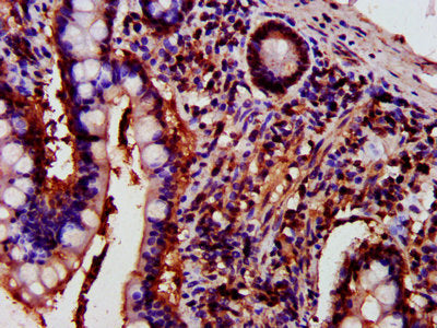 IHC image of PRKCH Antibody diluted at 1:700 and staining in paraffin-embedded human small intestine tissue performed on a Leica BondTM system. After dewaxing and hydration, antigen retrieval was mediated by high pressure in a citrate buffer (pH 6.0). Section was blocked with 10% normal goat serum 30min at RT. Then primary antibody (1% BSA) was incubated at 4°C overnight. The primary is detected by a biotinylated secondary antibody and visualized using an HRP conjugated SP system.Rabbit anti-Human PRKCH Polyclonal Antibody
