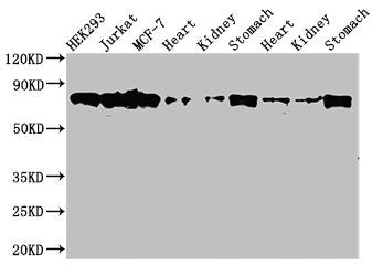 Western Blot  | Positive WB detected in: HEK293 whole cell lysate, Jurkat whole cell lysate, MCF-7 whole cell lysate, Rat heart tissue, Rat kideny tissue, Rat stomach tissue, Mouse heart tissue, Mouse kidney tissue, Mouse stomach tissue  | All lanes: PRKCH antibody at 3.5µg/ml  | Secondary  | Goat polyclonal to rabbit IgG at 1/50000 dilution  | Predicted band size: 78, 60 kDa  | Observed band size: 78 kDaRabbit anti-Human PRKCH Polyclonal Antibody