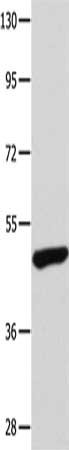 Gel: 10%SDS-PAGE, Lysate: 40 μg, Lane: Mouse bladder tissue, Primary antibody: TP63 Antibody(TP63 Antibody) at dilution 1/400, Secondary antibody: Goat anti rabbit IgG at 1/8000 dilution, Exposure time: 2 minutesRabbit anti-Human TP63 Polyclonal Antibody