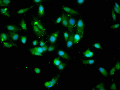 Immunofluorescence staining of Hela cells with AKT1 Antibody at 1:200, counter-stained with DAPI. The cells were fixed in 4% formaldehyde, permeabilized using 0.2% Triton X-100 and blocked in 10% normal Goat Serum. The cells were then incubated with the antibody overnight at 4°C. The secondary antibody was Alexa Fluor 488-congugated AffiniPure Goat Anti-Rabbit IgG(H+L).Rabbit anti-Human AKT1 Polyclonal Antibody