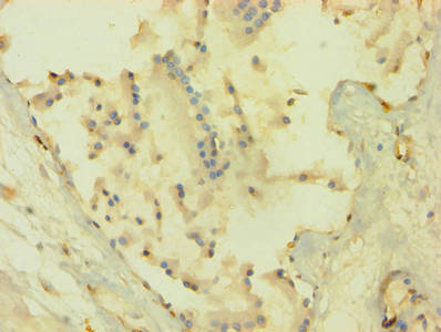 Immunohistochemistry of paraffin-embedded human prostate tissue using the antibody at dilution of 1:100Rabbit anti-Human AKT1 Polyclonal Antibody