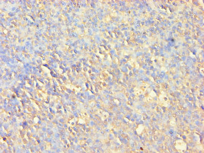 Immunohistochemistry of paraffin-embedded human tonsil tissue using AKT1 Antibody at dilution of 1:100Rabbit anti-Human AKT1 Polyclonal Antibody