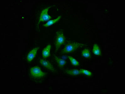 Immunofluorescence staining of A549 cells with AKT2 Antibody at 1:466, counter-stained with DAPI. The cells were fixed in 4% formaldehyde, permeabilized using 0.2% Triton X-100 and blocked in 10% normal Goat Serum. The cells were then incubated with the antibody overnight at 4°C. The secondary antibody was Alexa Fluor 488-congugated AffiniPure Goat Anti-Rabbit IgG(H+L).Rabbit anti-Human AKT2 Polyclonal Antibody