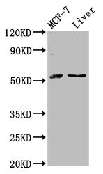 Western Blot  | Positive WB detected in: MCF-7 whole cell lysate, Rat liver tissue  | All lanes: AKT2 antibody at 2.8µg/ml  | Secondary  | Goat polyclonal to rabbit IgG at 1/50000 dilution  | Predicted band size: 56, 52 kDa  | Observed band size: 56 kDaRabbit anti-Human AKT2 Polyclonal Antibody