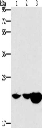 Gel: 10%SDS-PAGE, Lysate: 40 μg, Lane 1-3: Mouse kidney tissue, Mouse liver tissue, human fetal liver tissue, Primary antibody: HRASLS2 Antibody(HRASLS2 Antibody) at dilution 1/362.5, Secondary antibody: Goat anti rabbit IgG at 1/8000 dilution, Exposure time: 40 secondsRabbit anti-Human HRASLS2 Polyclonal Antibody