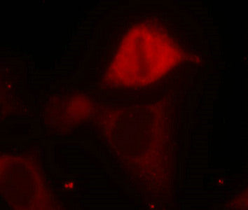 Immunofluorescence staining of methanol-fixed Hela cells using MKK3(Phospho-Ser189) Antibody.