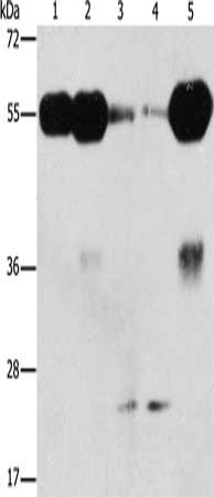 Gel: 10%SDS-PAGE, Lysate: 40 μg, Lane 1-5: Mouse brain tissue, human fetal brain tissue, mouse testis tissue, hela cells, human fetal kidney tissue, Primary antibody: PIK3R3 Antibody(PIK3R3 Antibody) at dilution 1/250, Secondary antibody: Goat anti rabbit IgG at 1/8000 dilution, Exposure time: 2 minutesRabbit anti-Human PIK3R3 Polyclonal Antibody