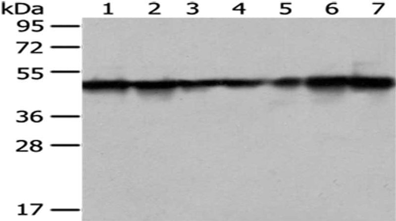 Gel: 8%SDS-PAGE, Lysate: 40 μg, Lane 1-7: 293T, hela and hepg2 cell, human placenta and fetal muscle tissue, PC3 and HT-29 cell, Primary antibody: TXNDC5 Antibody(TXNDC5 Antibody) at dilution 1/500 dilution, Secondary antibody: Goat anti rabbit IgG at 1/8000 dilution, Exposure time: 7 secondsRabbit anti-Human TXNDC5 Polyclonal Antibody