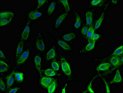 Immunofluorescent analysis of Hela cells using FOXO1 Antibody at dilution of 1:100 and Alexa Fluor 488-congugated AffiniPure Goat Anti-Rabbit IgG(H+L)Rabbit anti-Human FOXO1 Polyclonal Antibody