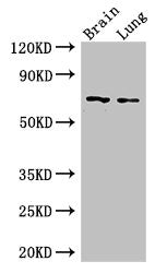 Western Blot | Positive WB detected in: Mouse brain tissue, Mouse lung tissue | All lanes: FOXO1 antibody at 2.5μg/ml | Secondary | Goat polyclonal to rabbit IgG at 1/50000 dilution | Predicted band size: 70 kDa | Observed band size: 70 kDaRabbit anti-Human FOXO1 Polyclonal Antibody