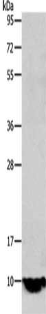 Gel: 10+12%SDS-PAGE, Lysate: 40 μg, Lane: Mouse intestinum tenue tissue, Primary antibody: TFF1 Antibody(TFF1 Antibody) at dilution 1/350, Secondary antibody: Goat anti rabbit IgG at 1/8000 dilution, Exposure time: 2 minutesRabbit anti-Human TFF1 Polyclonal Antibody