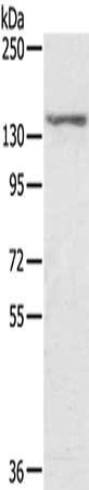 Gel: 6%SDS-PAGE, Lysate: 40 μg, Lane: MCF7 cells, Primary antibody: STAG2 Antibody(STAG2 Antibody) at dilution 1/300, Secondary antibody: Goat anti rabbit IgG at 1/8000 dilution, Exposure time: 5 secondsRabbit anti-Human STAG2 Polyclonal Antibody