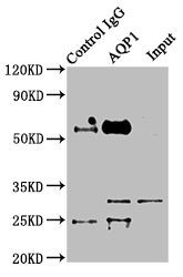 Immunoprecipitating AQP1 in Mouse skeletal muscle tissue  | Lane 1: Rabbit control IgG instead of AQP1 Antibody in Mouse skeletal muscle tissue. For western blotting, a HRP-conjugated Protein G antibody was used as the secondary antibody (1/2000)  | Lane 2: AQP1 Antibody (8µg) + Mouse skeletal muscle tissue (500µg)  | Lane 3: Mouse skeletal muscle tissue (10µg)Rabbit anti-Human AQP1 Polyclonal Antibody
