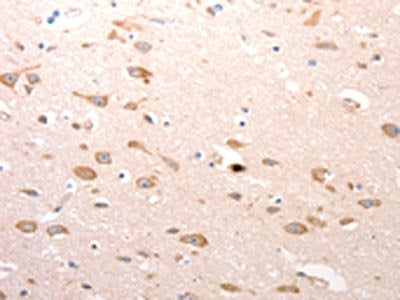 The image on the left is immunohistochemistry of paraffin-embedded Human brain  tissue using CDC37 Antibody(CDC37 Antibody) at dilution 1/20, on the right is treated with synthetic peptide. (Original magnification: ×200)Rabbit anti-Human CDC37 Polyclonal Antibody