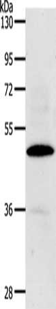 Gel: 10%SDS-PAGE, Lysate: 40 μg, Lane: Hela cells, Primary antibody: CDC37 Antibody(CDC37 Antibody) at dilution 1/100, Secondary antibody: Goat anti rabbit IgG at 1/8000 dilution, Exposure time: 90 secondsRabbit anti-Human CDC37 Polyclonal Antibody