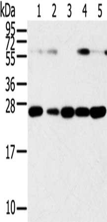 Gel: 12%SDS-PAGE, Lysate: 40 μg, Lane 1-6: Human placenta tissue, hela cells, hepg2 cells, human fetal liver tissue, A549 cells, human normal kidney tissue, Primary antibody: SNAP23 Antibody(SNAP23 Antibody) at dilution 1/400, Secondary antibody: Goat anti rabbit IgG at 1/8000 dilution, Exposure time: 15 secondsRabbit anti-Human SNAP23 Polyclonal Antibody