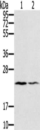 Gel: 12%SDS-PAGE, Lysate: 40 μg, Lane 1-2: Human normal right lung tissue, Human normal left lung tissue, Primary antibody: EDN2 Antibody(EDN2 Antibody) at dilution 1/600, Secondary antibody: Goat anti rabbit IgG at 1/8000 dilution, Exposure time: 2 minutesRabbit anti-Human EDN2 Polyclonal Antibody