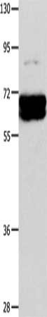 Gel: 10%SDS-PAGE, Lysate: 40 μg, Lane: Mouse brain tissue, Primary antibody: CRMP1 Antibody(CRMP1 Antibody) at dilution 1/350, Secondary antibody: Goat anti rabbit IgG at 1/8000 dilution, Exposure time: 2 secondsRabbit anti-Human CRMP1 Polyclonal Antibody