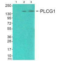 Western blot analysis of extracts from COS7 cells (Lane 2), and JK cells (Lane 3), using PLCG1 (Ab-771) antiobdy. The lane on the left is treated with synthesized peptide.Rabbit anti-Human PLCG1 Polyclonal Antibody
