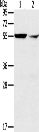 Gel: 8%SDS-PAGE, Lysate: 40 μg, Lane 1-2: K562 cells, human fetal liver tissue, Primary antibody: PPM1F Antibody(PPM1F Antibody) at dilution 1/200, Secondary antibody: Goat anti rabbit IgG at 1/8000 dilution, Exposure time: 10 secondsRabbit anti-Human PPM1F Polyclonal Antibody