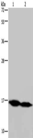 Gel: 10%SDS-PAGE, Lysate: 40 μg, Lane 1-2: Mouse skeletal muscle, human hepatocellular carcinoma tissue, Primary antibody: NDUFA13 Antibody(NDUFA13 Antibody) at dilution 1/350, Secondary antibody: Goat anti rabbit IgG at 1/8000 dilution, Exposure time: 5 minutesRabbit anti-Human NDUFA13 Polyclonal Antibody