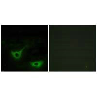 Immunofluorescence analysis of NIH/3T3 cells, using CALR antibody.