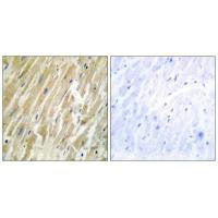 Immunohistochemistry analysis of paraffin-embedded human heart tissue using CALR antibody.