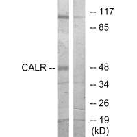 Western blot analysis of extracts from COS-7 cells, using CALR antibody.