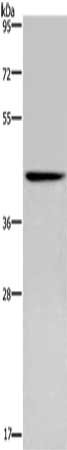 Gel: 8%SDS-PAGE, Lysate: 40 μg, Lane: Human fetal brain tissue, Primary antibody: CERS5 Antibody(CERS5 Antibody) at dilution 1/350, Secondary antibody: Goat anti rabbit IgG at 1/8000 dilution, Exposure time: 5 minutesRabbit anti-Human CERS5 Polyclonal Antibody
