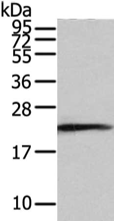 Gel: 12%SDS-PAGE, Lysate: 40 μg, Lane: Hela cell, Primary antibody: RAB2A Antibody(RAB2A Antibody) at dilution 1/350 dilution, Secondary antibody: Goat anti rabbit IgG at 1/8000 dilution, Exposure time: 2 minutesRabbit anti-Human RAB2A Polyclonal Antibody
