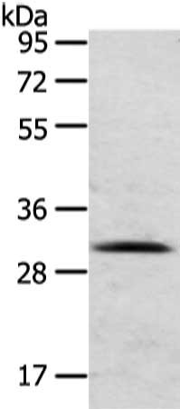 Gel: 8%SDS-PAGE, Lysate: 40 μg, Lane: Human normal liver tissue, Primary antibody: TIGAR Antibody(TIGAR Antibody) at dilution 1/200 dilution, Secondary antibody: Goat anti rabbit IgG at 1/8000 dilution, Exposure time: 10 secondsRabbit anti-Human TIGAR Polyclonal Antibody