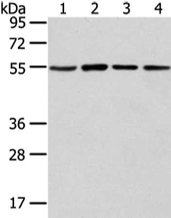 Gel: 8%SDS-PAGE, Lysate: 40 μg, Lane 1-4: NIH/3T3, K562, A431 and hela cell, Primary antibody: TUBA1C Antibody(TUBA1C Antibody) at dilution 1/300 dilution, Secondary antibody: Goat anti rabbit IgG at 1/8000 dilution, Exposure time: 10 secondsRabbit anti-Human TUBA1C Polyclonal Antibody