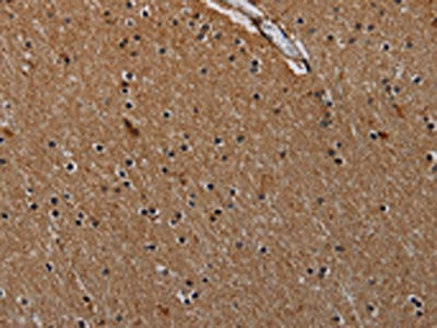 The image on the left is immunohistochemistry of paraffin-embedded Human brain  tissue using IVL Antibody(IVL Antibody) at dilution 1/50, on the right is treated with synthetic peptide. (Original magnification: ×200)