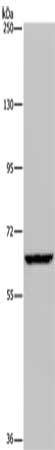Gel: 6%SDS-PAGE, Lysate: 40 μg, Lane: Hela cells, Primary antibody: IVL Antibody(IVL Antibody) at dilution 1/200, Secondary antibody: Goat anti rabbit IgG at 1/8000 dilution, Exposure time: 20 seconds