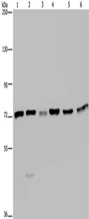 Gel: 6%SDS-PAGE, Lysate: 40 μg, Lane 1-6: K562 cells, A549 cells, HT29 cells, 293T cells, Hela cells, Jurkat cells, Primary antibody: KARS Antibody(KARS Antibody) at dilution 1/350, Secondary antibody: Goat anti rabbit IgG at 1/8000 dilution, Exposure time: 20 seconds